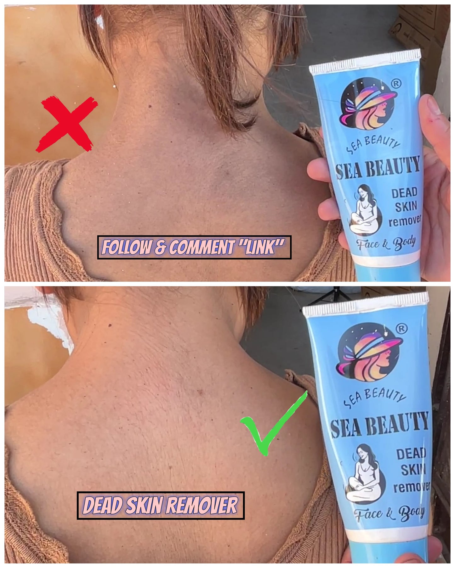 Sea beauty dead skin remover result
