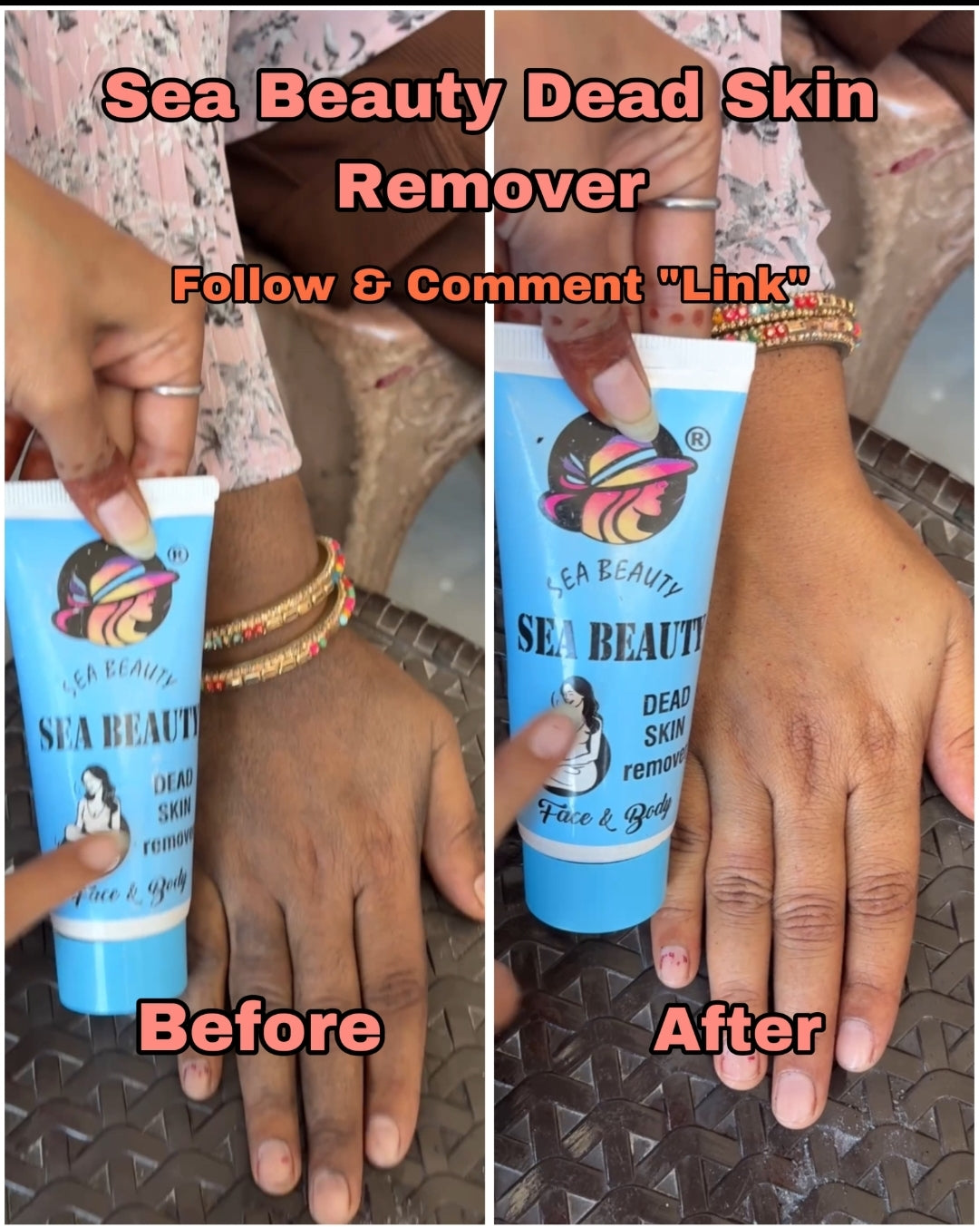 Sea beauty dead skin remover result